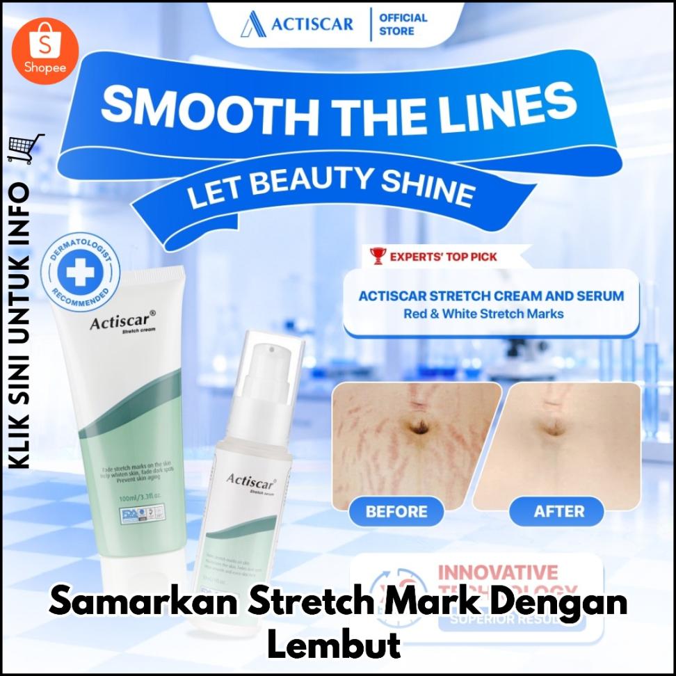 Samarkan Stretch Mark Dengan Lembut