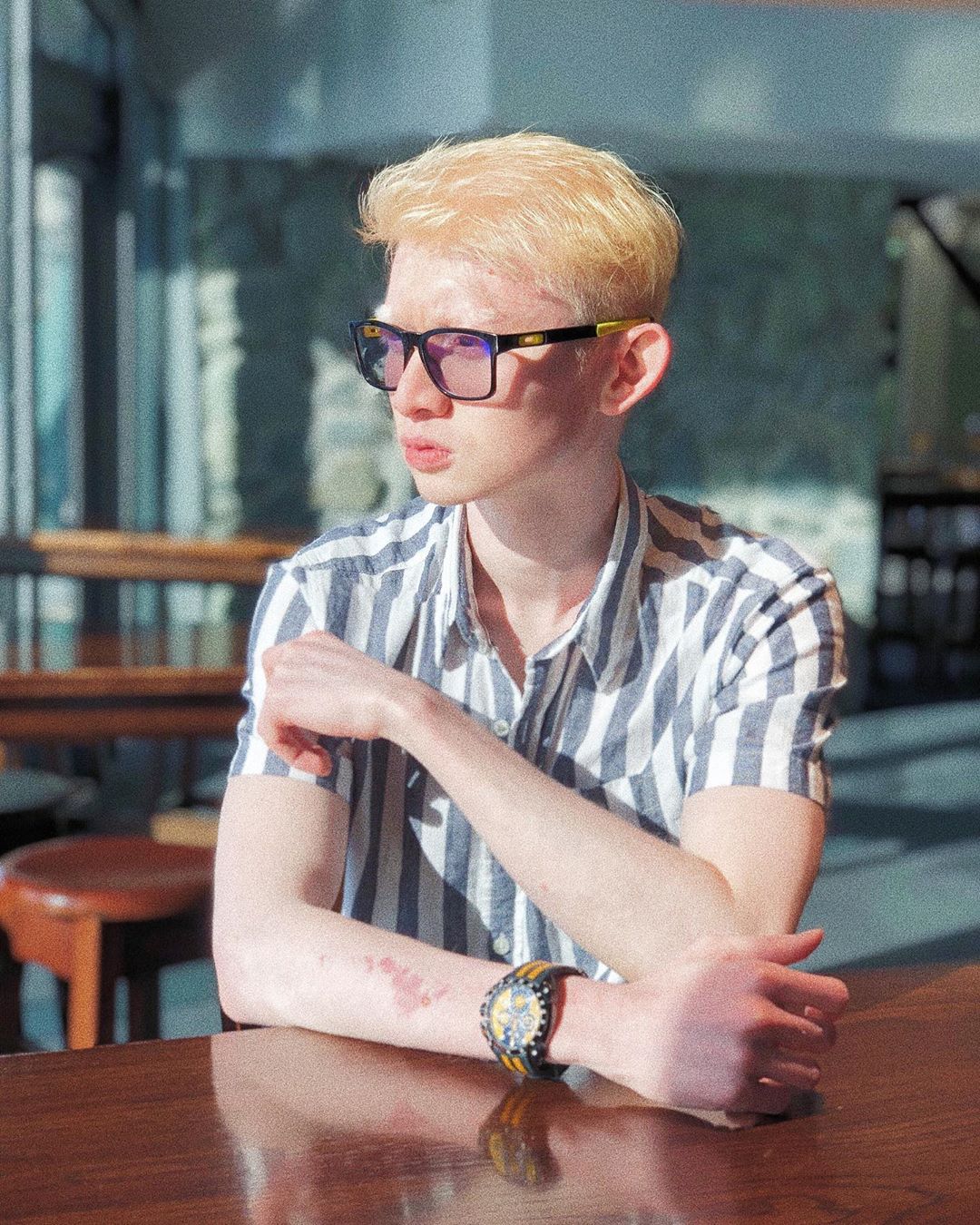 ‘Koyak’ Dihentam Model Albino, Jejaka Sado Akui Tak Profesional & Minta Maaf