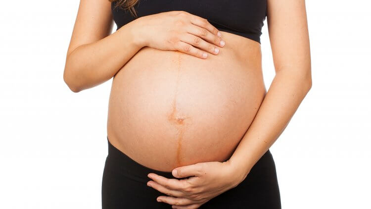 Garisan Hitam Bukannya Punca Kehamilan Bermasalah – Doktor Ini Beri Penjelasan