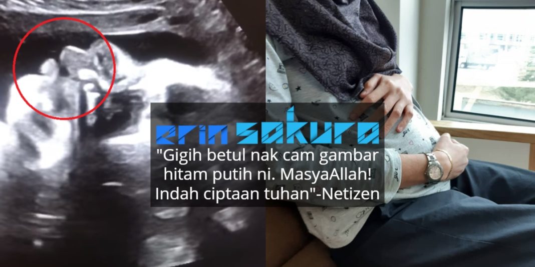 VIDEO Dr Imelda Kongsi Adegan Baby 'Minum' Air Ketuban ...