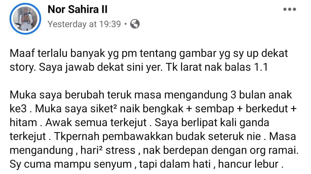 Wajah Bengkak & Kedut Seakan Orang Tua, Wanita Alami Alahan Teruk Semasa Hamil