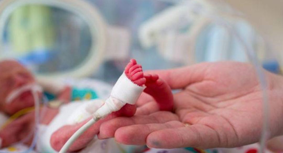 Gara-Gara Si Ibu Taksub Nak Cantik & Putih, 3 Bayi Akhirnya Dilahir Pramatang..