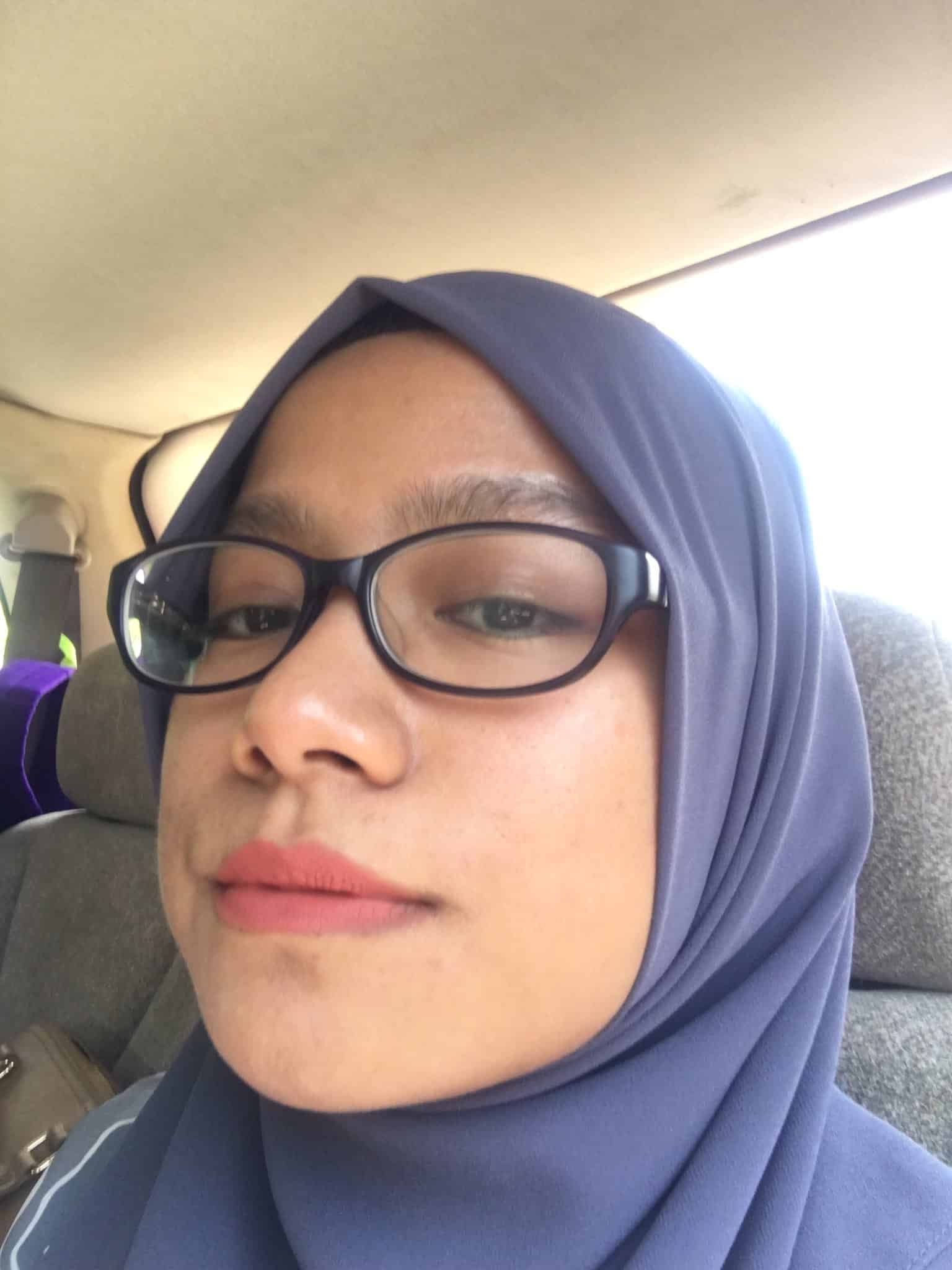 Pakai Skincare Apa Pun Tak Akan Jadi, Badan Penuh Toksin Punca Kulit Breakout