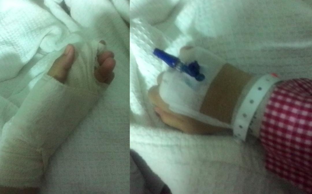 2 Kali Jalani Operation, Gadis Dedah Pengalaman Ngeri Digigit Kucing Kesayangan