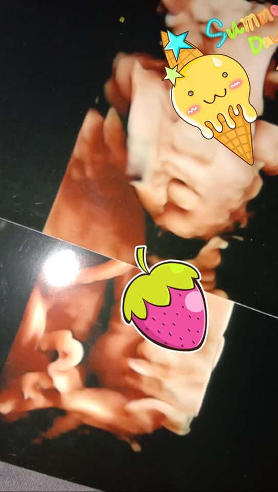2 Hari Lagi Nak Sambut Baby Kembar, Tapi Allah Uji ‘Ambil’ Semula Serentak