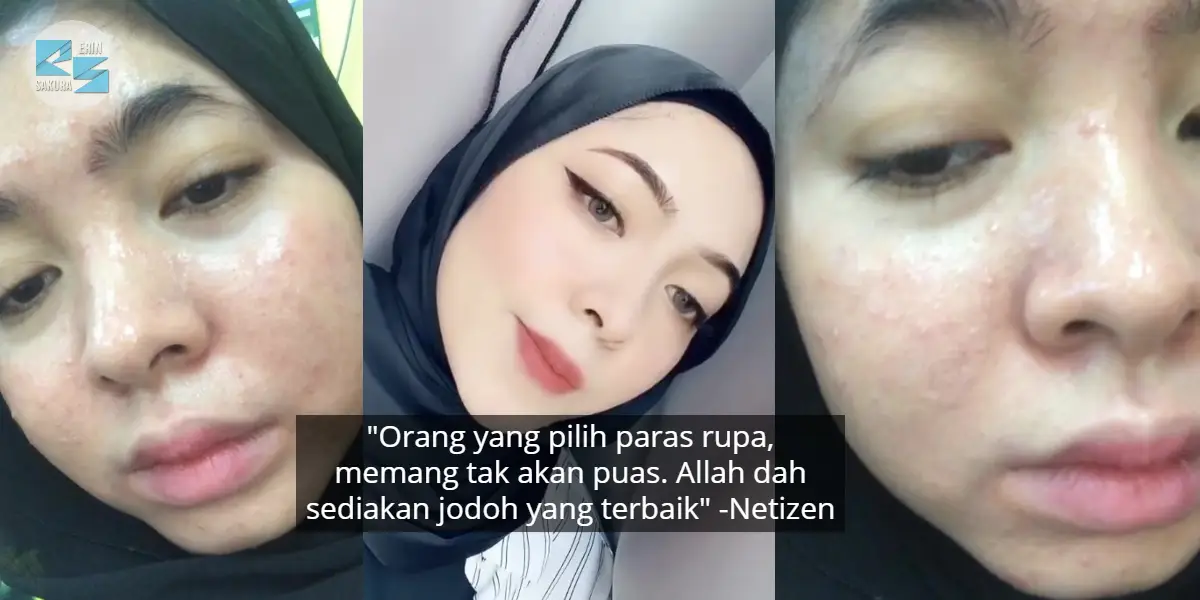 [VIDEO] Ditinggalkan Boyfriend Kerana Wajah, Gadis Bangkit Dengan Imej Flawless