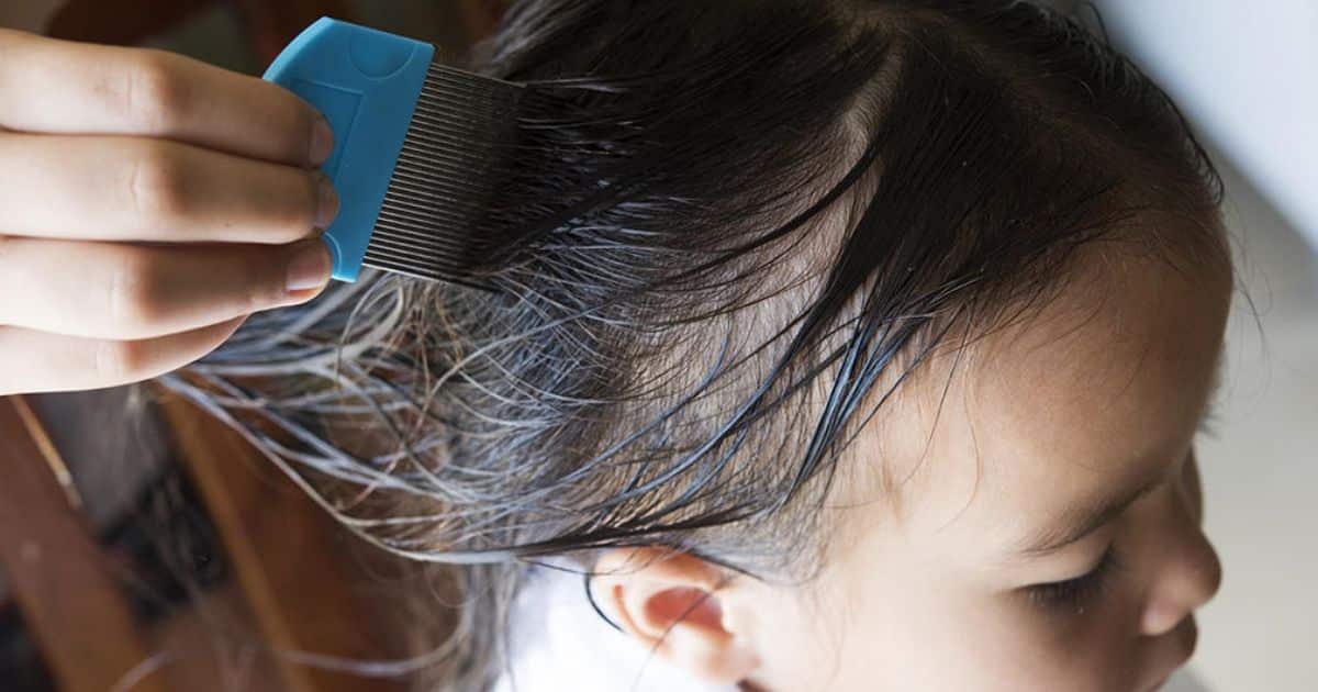 3 Tahun Derita Kutu Rambut, Budak 12 Tahun Akhirnya Ajal Sebab Masalah Jantung