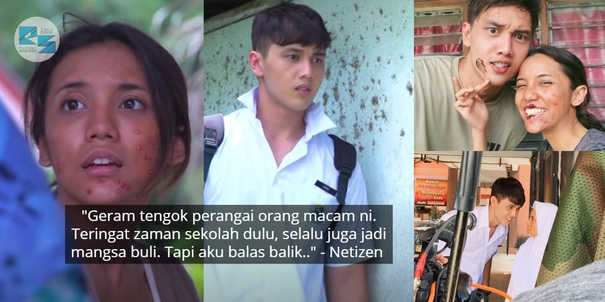 Tak Yakin Sebab Muka Berjerawat, Drama ‘Bidadari Salju’ Dedah Realiti Sebenar