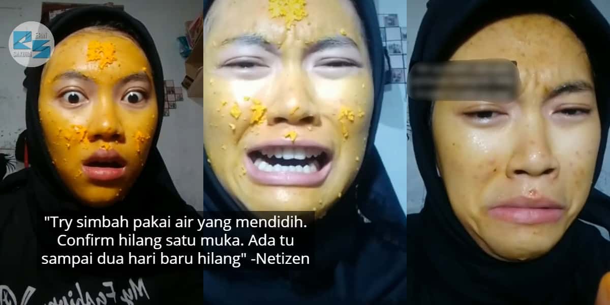Penat Basuh Guna Air Hangat, Gadis Cuak Muka Kuning Lepas Try Masker Kunyit